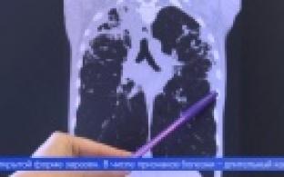 О мерах профилактики туберкулёза