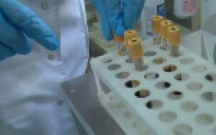 5 839 случаев ВИЧ-инфекции было зарегистрировано в Первоуральске с 1990 года