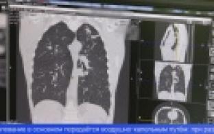 О необходимости профилактики туберкулёза напоминают медики