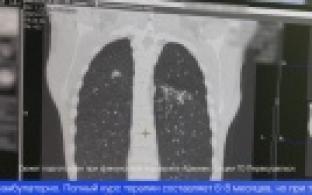 Туберкулёз – опасное заболевание