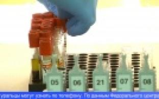 Горячую линию по вопросам профилактики ВИЧ запустят в Свердловской области