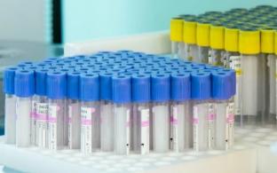 Обязательное тестирование для путешественников