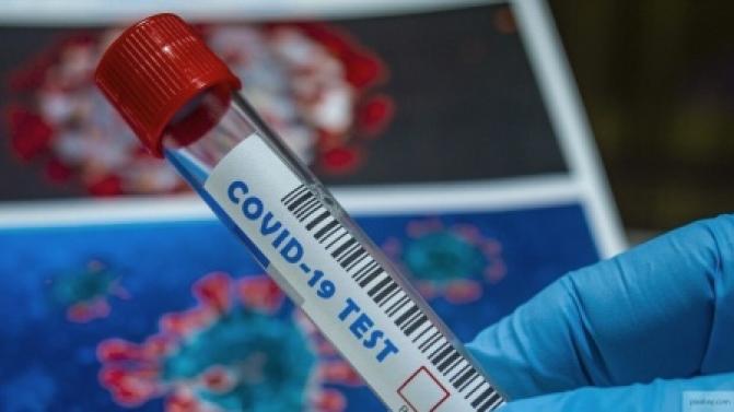 Роспотребнадзор изменил правила сдачи ПЦР-тестов на COVID для прибывающих из-за рубежа жителей России