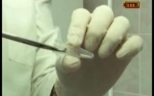 От укусов клещей пострадали уже больше восьмисот первоуральцев