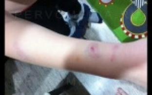 10-летний школьник спас малыша от разъярённой собаки.