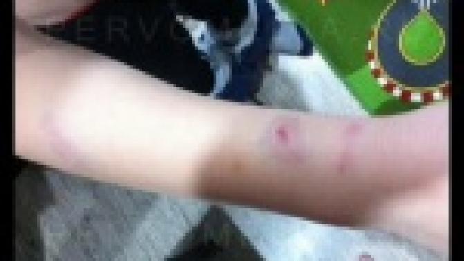 10-летний школьник спас малыша от разъярённой собаки.